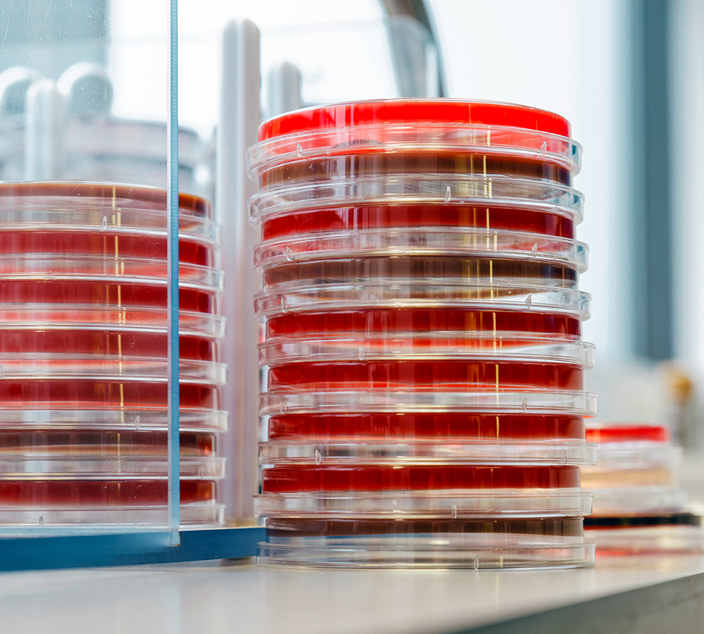 A stack of Petri dishes with red culture medium stands on a laboratory bench. These dishes are used to examine bacterial cultures, such as staphylococci, which are responsible for bloodstream infections. Such tests are essential for the development of effective antibiotic therapy, as in the clinical application HELP.